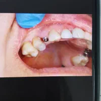 مرکزفوق تخصصی ایمپلنت دیجیتال/یکروزه/سبک کاخ لبخند