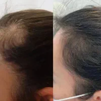 نذار دیر شه