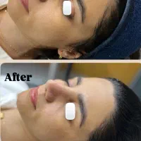 فیشال (پاکسازی)تخصصی پوست