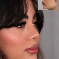 جراحی بینی بدون تامپون فقط با ۳۵ میلیون ‌