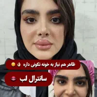 جراحی زیبایی/پلک بالا/پایین/سانترال لب/بوکال فت