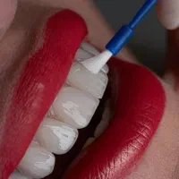 دندانپزشکی ولیعصر تعرفه دولتی و بیمه های تکمیلی