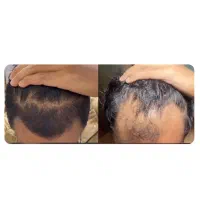 ۲ روز دیگه میری جلو آیینه میبینی کچل شدی ...