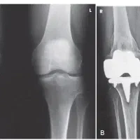 رادیولوژی سونوگرافی سوندپانسمان بخیه فصدخون درمنزل