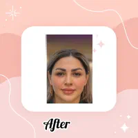 استخدام منشی مطب پوست وزیبایی