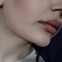 جشنواره تخصصی بوتاکس  فیلر و زاویه‌سازی در کلینیک