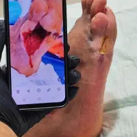 مرکز تخصصی مراقبت از زخم