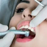 خدمات ترمیم پوسیدگی دندان در دانشکده دندانپزشکی