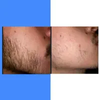 ریش داشته باشی اعتبارت زیاد میشه