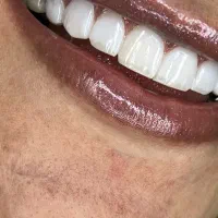 تخفیف کامپوزیت ۱۹۰۰ برند انگلیسی