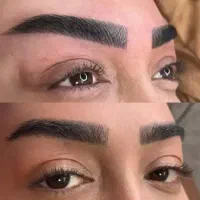 فیبروز ابرو