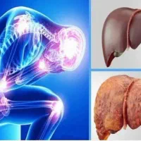 درمان کبد چرب