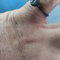 نشان|جواهرات|گرگان, |دیوار