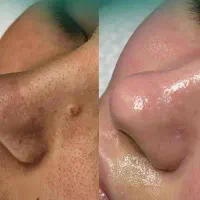 فیشیال تخصصی از 600تا 1تومن