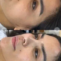 جشنواره پاکسازی و فشیال تخصصی (تخفیف محدود)