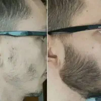 آنتی کنسلی