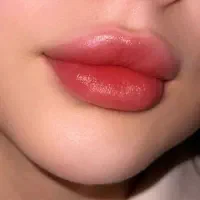 مدل فیلرلب آنزیم بوتاکس مادلینگ صورت لیفت شقیقه