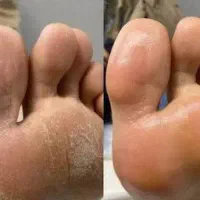 کف سابی (پدیکور)