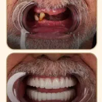 نیازمند تراکت پخش کن خانم با سابقه و ظاهری آراسته