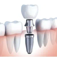 دستیار مطب دندانپزشکی