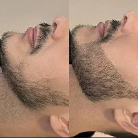 حمله به سمت جذابیت