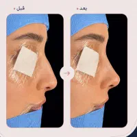 جراحی بینی اقساطی/ماهی ۷۸۰۰