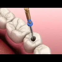 خدمات دندانپزشکی درمانی ترمیمی و زیبایی