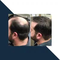 از ریزش تا رویش