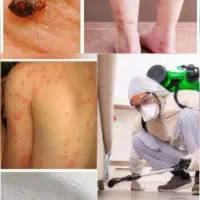 سمپاشی  تضمینی ساس کنه پشه