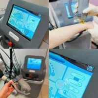 دستگاه الکساندرایت کندلا کپی ۲۰۲۴