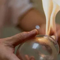 حجامت بادکش گرم فصد خون زالو درمانی مزاج شناسی