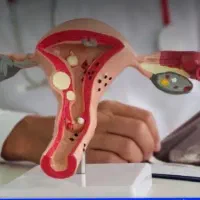 درمان قطعی مشکلات زنان تضمینی