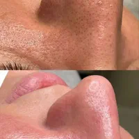 فیشال تخصصی با50%دستگاه تخصصی/پاکسازی