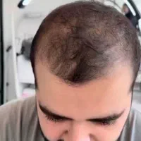 مخصوص کچلا