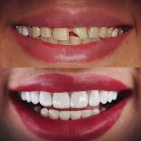 دندانپزشکی تخصصی تضمینی و اقساطی در نیشابور