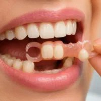 جای خالی دندانت رو سریع پر کن /فقط ۴ میلیون