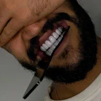کامپوزیت ونیر ۳۰درصد تخفیف محرمی فقط10روز