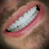 خدمات دندانپزشکی با اقساط ویژه