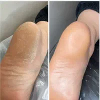آموزش پدیکور