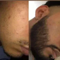 خودتو دوست داشته باش و پکیج رویش بخر