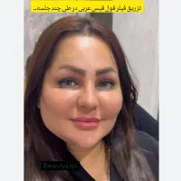 ژل/بوتاکس/تزریق چربی/مزوژل/چالگونه
