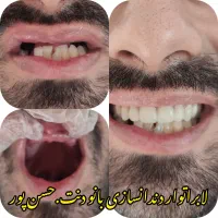 امروز دندان بزار.دو ماه دیگه پولش رو بده