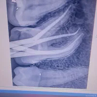 dentist endo|خدمات آرایشگری و زیبایی|کرمانشاه, |دیوار