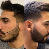 معجون اختصاصی رویش ریش وسیبیل