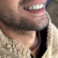 دندان مصنوعی دندانسازی کرمان