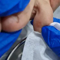 آموزش تخصصی پدیکوردرمانی،میخچه،مانیکور و اسپای دست