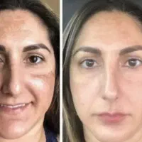 ،ضدافتاب،ضدمنافذ،محافظ پوست،کرم شب