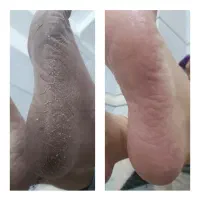 پدیکور