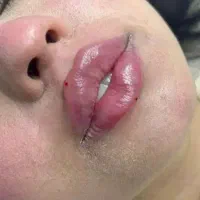 ماساژ صورتی