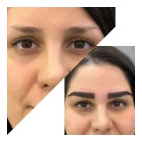 زیبایی بیشتر با کاشت ابرو